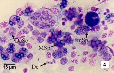 Marteilia sydneyi (QX Disease)