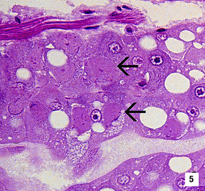 Baculoviral Midgut Gland Necrosis