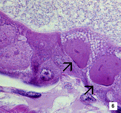 Baculoviral Midgut Gland Necrosis