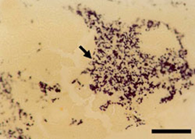  infection with Bonamia exitiosus