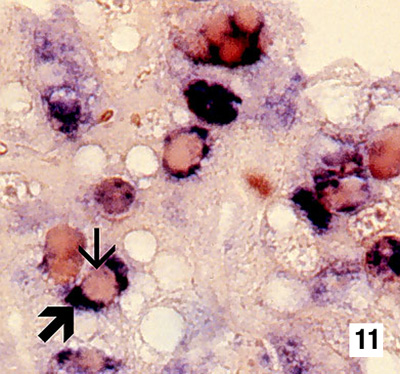  Spherical Baculovirosis