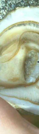 infection with mikrocytos mackini