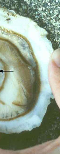 infection with mikrocytos mackini